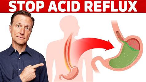 How to STOP Acid Reflux Instantly - YouTube