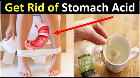 Stomatch Acidity | How To Get rid of Stomach Acid pain - YouTube