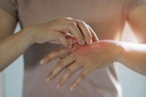 Degloving Injuries: Symptoms, Causes, Treatment - Maison Law