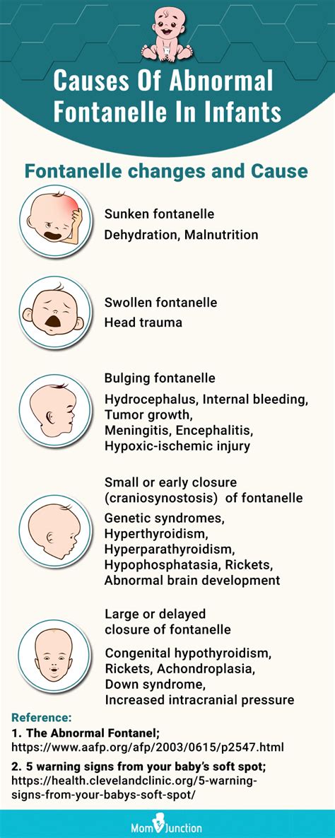 Baby Sunken Fontanelle (Soft Spot): Signs, Causes & Treatment | MomJunction