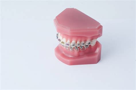 What role do Rubber Bands play in Orthodontics?