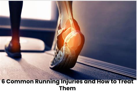 The 6 Common Running Injuries and How to Treat Them - The Ace Fitness