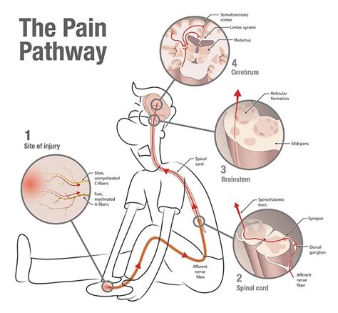 What a Pain! — Insight Massage