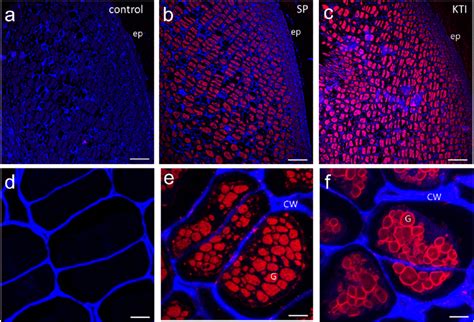 Laser-scanning confocal micrographs of Kunitz trypsin inhibitor (KTI)... | Download Scientific ...