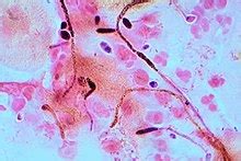 Candida albicans - Wikipedia