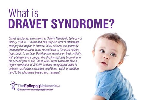 Dravet Syndrome is also knows as Severe Myoclonic Epilepsy of Infancy (SMEI), is a rare and ...