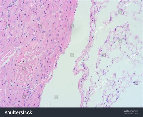 Histology Human Heart Tissue Show Cardiac Stock Photo 634973237 | Shutterstock