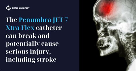 Penumbra Stroke Risk: Does the JET 7 Xtra Flex Catheter Cause Strokes? | Riddle & Brantley