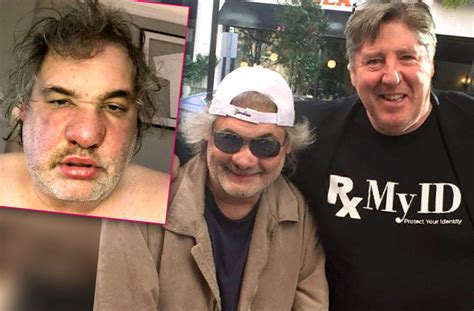 Artie Lange Posts Shocking Photo After Hospitalization