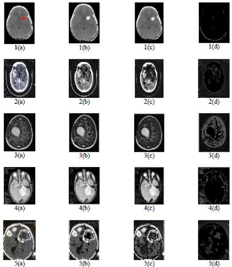 Input and the corresponding processed MRI scans with different types of... | Download Scientific ...