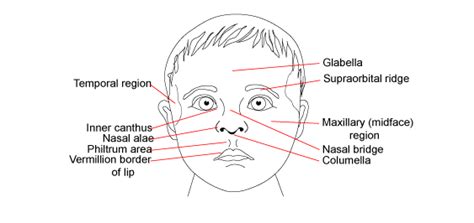 Genetic Epilepsy Syndrome With Classic Dysmorphism, 55% OFF