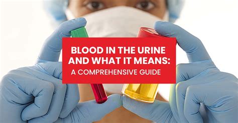 Blood in the Urine: A Comprehensive Guide – Medbury Medical Services