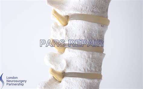 Pars repair - London Neurosurgery - Spine & Neurosurgery