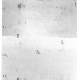 Coomassie blue+tained preparatwe two-dimensional gel electrophoresis of... | Download Scientific ...