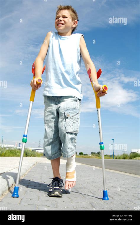 Boy with broken leg Stock Photo - Alamy