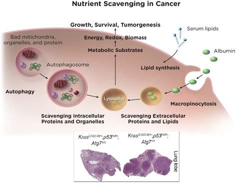 Cancer Metabolism | Rutgers Cancer Institute of New Jersey