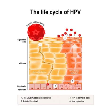 Hpv - Image to u