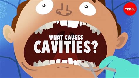 What causes cavities? - Mel Rosenberg - YouTube