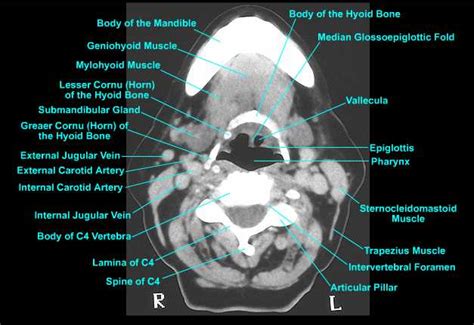 ct neck anatomy