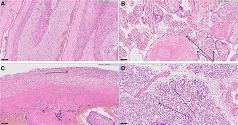 Histopathology images of normal amnion and abnormal amnion from the... | Download Scientific Diagram