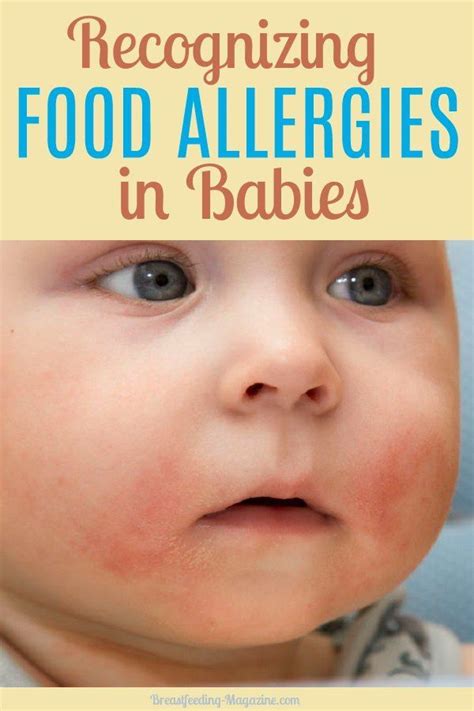 Signs Of Food Intolerance In Babies - BABBIES CIP