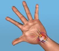 Peripheral Nerve Surgery Nedlands | Nerve Pain Surgery | Perth