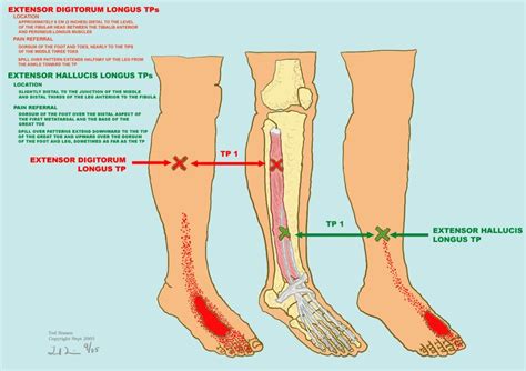 Pin on Extensor Hallucis Longus