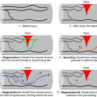 Axon regeneration versus axon sprouting after injury in the spinal cord ...