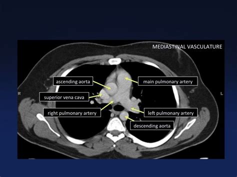 MDCT-atlas-6 / CTisus.com | Medical anatomy, Radiology imaging, Body anatomy