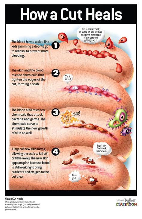 17 Best images about Pain & Inflammation on Pinterest | Back pain, Charts and Pain d'epices