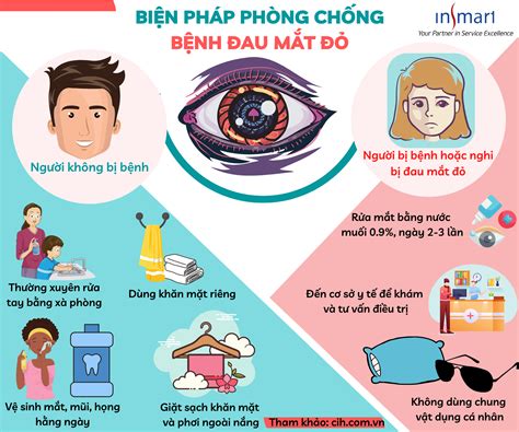 [HEALTH TIP] - Biện pháp phòng chống bệnh đau mắt đỏ - insmart