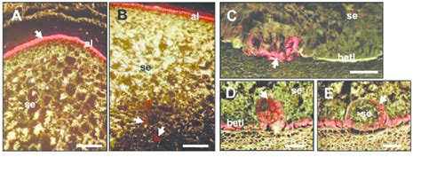 Aleurone cell abnormalities in glo1-1. pVP1-GUS analysis in 10 dap... | Download Scientific Diagram