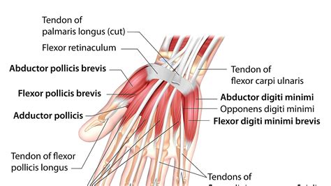 Hand Tendon Injury Symptoms - Injury Choices