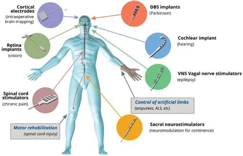 Designing next-generation neural interfaces with graphene