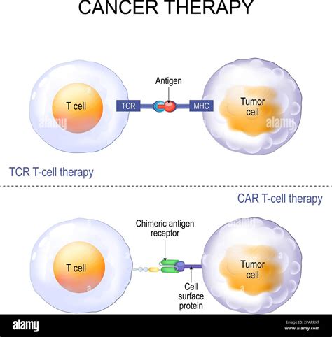 Cancer treatment. T-cell therapy with T cell receptor (TCR) or Chimeric ...