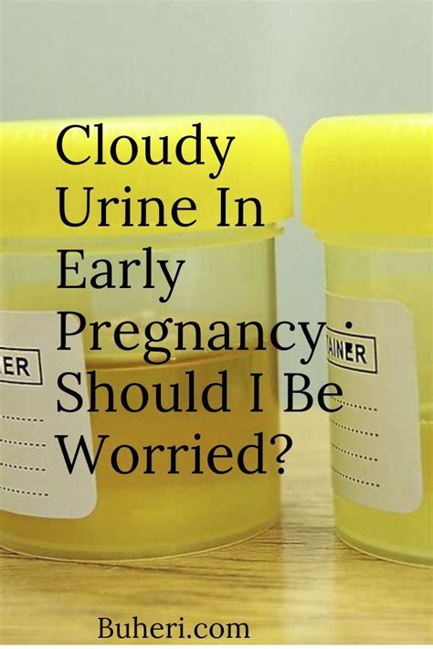 Pregnancy Urine Color Bright Yellow – Warehouse of Ideas