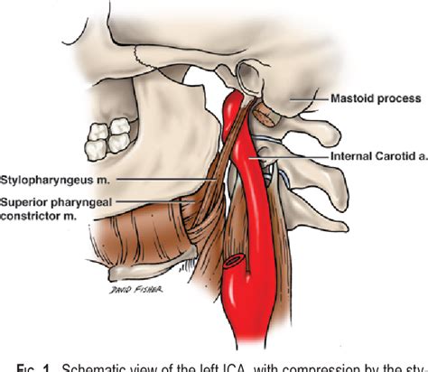 Stylopharyngeus muscle | Semantic Scholar