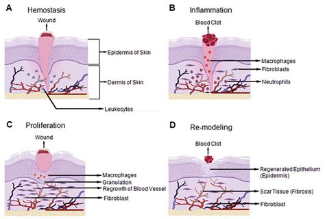 Wound healing stages demonstrated on the three layers of human skin.... | Download Scientific ...