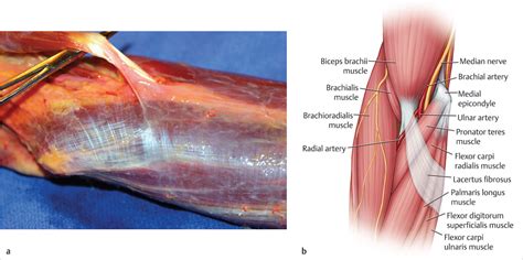 Antebrachial Fascia Anatomy