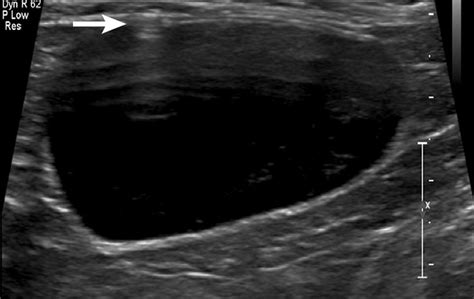 Guide to Performing Cystocentesis in Dogs & Cats | Clinician's Brief