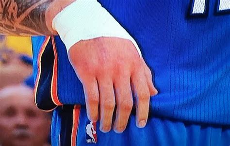 Steven Adams plays with thumb injury, bloody nose | Larry Brown Sports