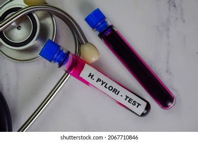 H Pylori Test Blood Sample Top Stock Photo 2067710846 | Shutterstock