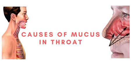 Causes of Mucus in Throat | Mucus in throat, Mucus, Throat