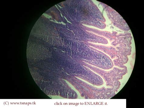 Histology Slides Database: ileum histology slides