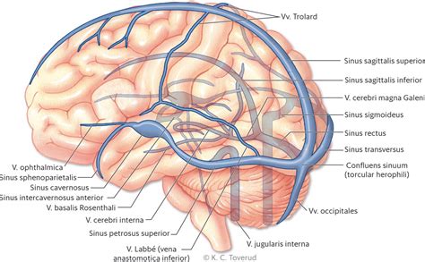 Cerebral venetrombose – forekomst, diagnostikk og behandling | Tidsskrift for Den norske ...