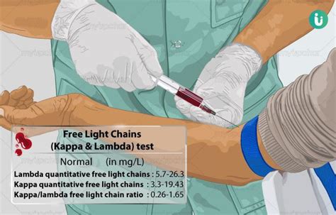 Kappa Lambda Light Chains Free With Ratio Serum | Shelly Lighting