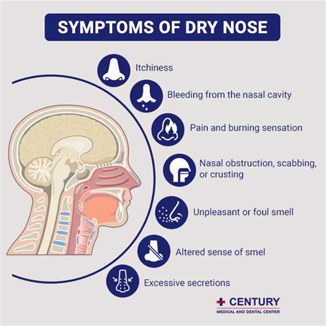 Effective Ways To Treat a Dry Nose - Century Medical & Dental Center