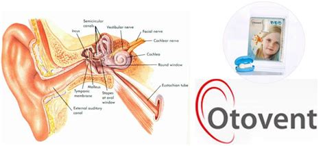 Reasons and Symptoms of Fluid Inner Ear | Inner ear, Ezine, Fluid