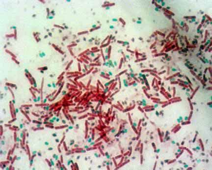 Endospore Stain Clostridium