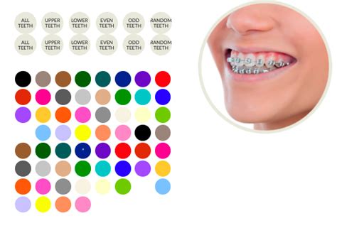 Smiles Hollywood McKinney Orthodontist | Cool Braces Colors